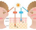 Infographic illustration of difference between UVA and UVB rays. UV penetration into human skin and woman face. skin care and