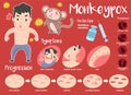 infographic about Monkeypox