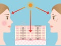 Infographic skin illustration. diagram of skin spot mechanism