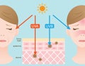 Infographic skin illustration. the difference between UVA and UVB rays penetration