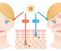 Infographic skin illustration. the difference between UVA and UVB rays penetration