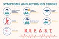 Infographic symptoms and action on stroke. Befast. Stroke awareness