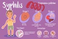 Infographic of Syphilis