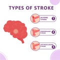 Infographic of types of brain stroke