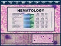 Infographic of a ui screen with medical report from Hematology laboratory. Illustration of user interface with results of blood