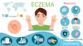 Infographics of eczema with reasons, man, pills