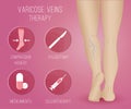 Infographics phlebology, treating varicose veins on women's legs