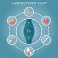 Infographics phlebology, treating varicose veins on women's legs