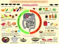 Infographics proper nutrition. Cholecystitis Royalty Free Stock Photo