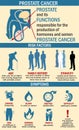 Infographics of prostate cancer illustration. Prostate cancer symptoms, risk factors.