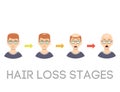 Information chart of hair loss stages types of baldness illustrated on male head vector.