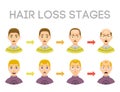 Information chart of hair loss stages types of baldness illustrated on male head vector.