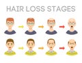 Information chart of hair loss stages types of baldness illustrated on male head vector.