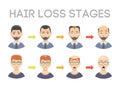 Information chart of hair loss stages types of baldness illustrated on male head vector.