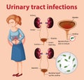 Informative illustration of urinary tract infections