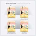 Ingrown Hair Structure