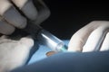 Injecting local anesthesia