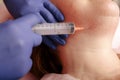 Injecting ozone to chin. This therapy is purposed to increase oxygen in a body. Horizontal closeup shot