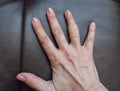 Injured hand with plaster. Palm with beige plaster on finger. Medical treatment concept. Blister and textile plaster Royalty Free Stock Photo