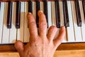 Injured male hand on the shiny piano keys. Top view