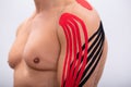 Man Having Physio Therapy Tape On His Arms