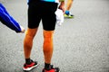 Injured marathon runner legs Royalty Free Stock Photo