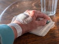 Injured painful hand with white bandage, take a plaster off the table Royalty Free Stock Photo