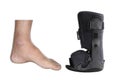 Injured patient ankle and a black controlled ankle motion also known as a `Moon Boot`