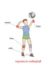 Injuries in volleyball. the picture shows the most injured