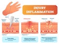 Injury inflammation biological human body response vector illustration scheme. Skin surface injury cross section poster.