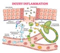 Injury inflammation as body response process in educational outline diagram Royalty Free Stock Photo