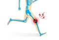 Injury of knee bone and leg while running