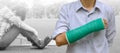 injury woman broken arm with green cast on arm standing on background injury woman sitting with arm splint and holding wooden