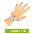 Insect bites allergy swelling human palm and pest