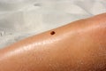 Insect ladybug walks on human skin Royalty Free Stock Photo