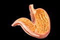 Inside of human stomach model on black background Royalty Free Stock Photo