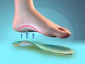 Foot arch support Royalty Free Stock Photo