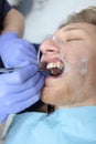 Installation of braces for alignment of the dentition or bite. New braces in the hands of a dentist. Unrecognizable