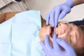 Installing braces on the upper row of teeth. A young man at an orthodontist`s appointment. Alignment of the dentition or