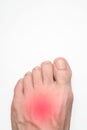 Instep of a person left foot with a red mark representing pain, with space above for text