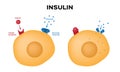 Insulin unlocks the cell`s glucose channel