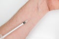 Insuline injector on the arm Royalty Free Stock Photo
