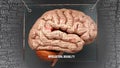 Intellectual disability in human brain