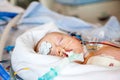 Intensive care, child Royalty Free Stock Photo