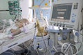 At the intensive care unit. Baby lying on a hospital bed attached to the reviving apparatus attached to the 