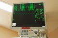 Intensive care unit monitor Royalty Free Stock Photo