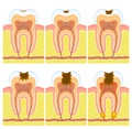 Internal structure of tooth Royalty Free Stock Photo