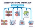 Interventional radiology as minimally invasive procedures outline diagram Royalty Free Stock Photo