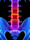 Intervertebral disks Royalty Free Stock Photo