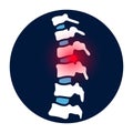 intervertebral hernia concept